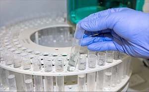 Reduce the Cost of Lab Testing