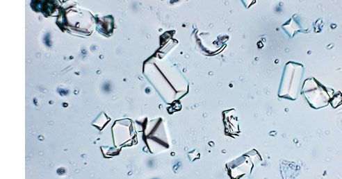 What Is Protein Crystallization?